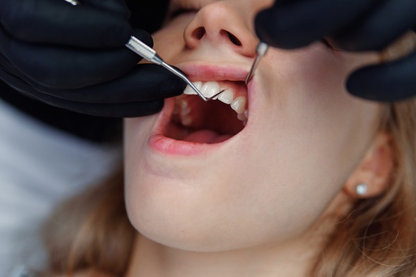 Gum Disease: What You Should Know